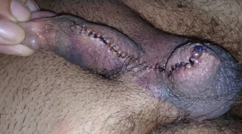 Dr Jose andres olivo garate