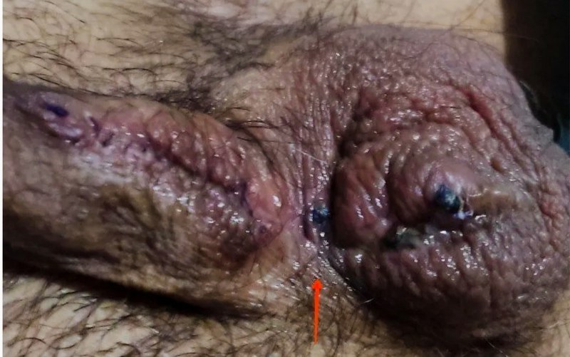 dr jose andres olivo garate