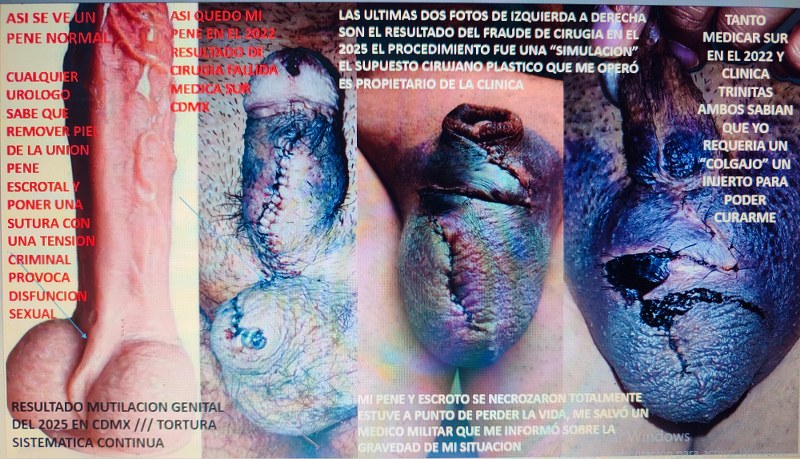 dr jose andres olivo garate uroguadalajara